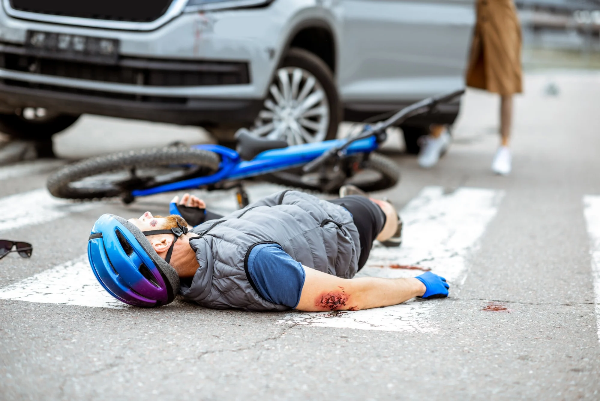 Bicycle Accidents Lawyer New Orleans